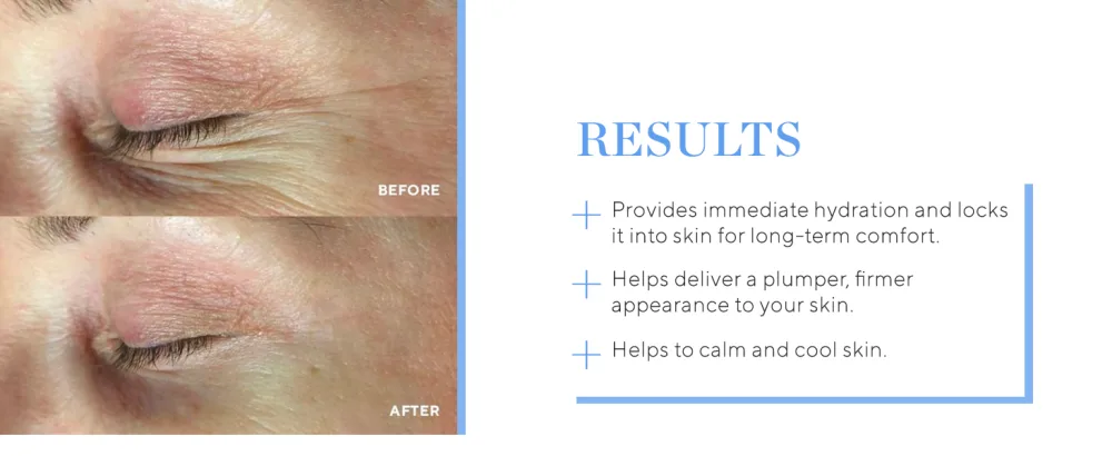 HydroPeptide PolyPeptide Collagel Eye Masks  Line-Lifting Hydrogel  Firmer Appearance and Hydration  8 Treatments - results
