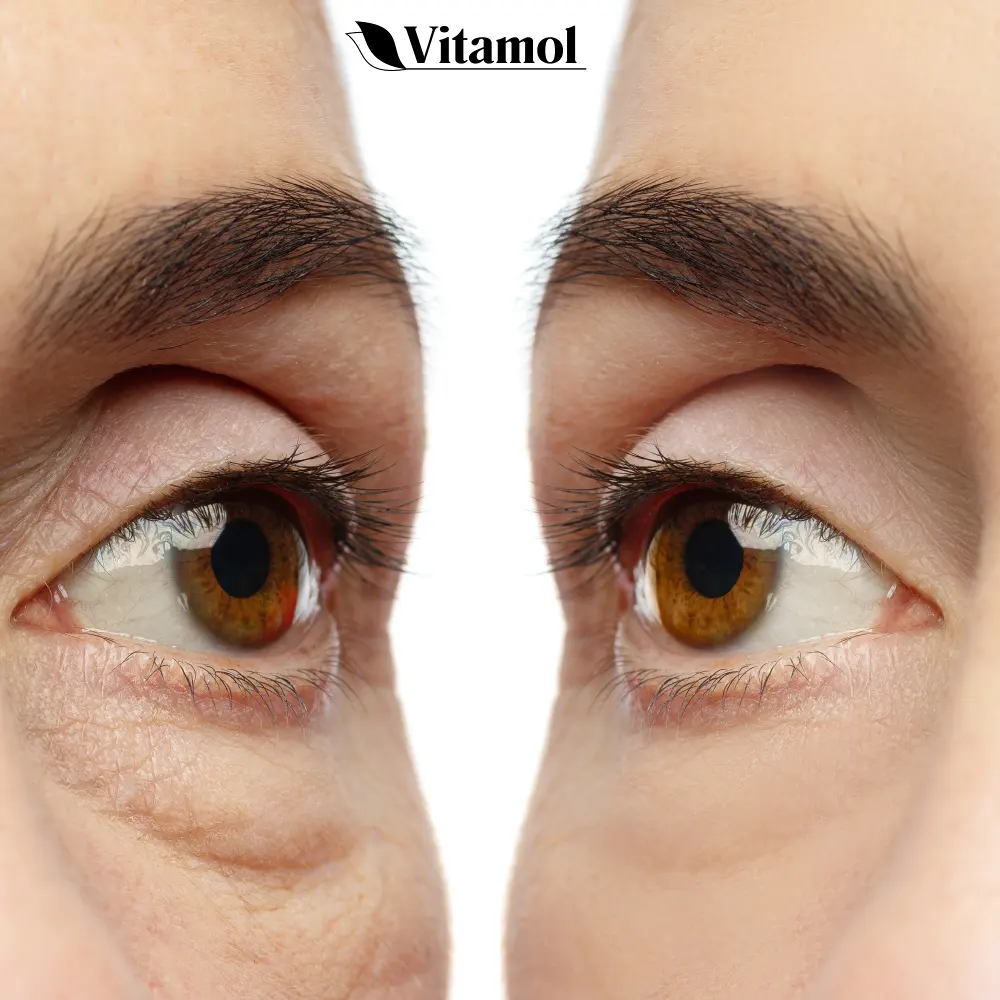 Vitamol Biosoft Cr me Contour des Yeux aux Cellules Souches Anti-Rides Peaux normales ou s ches 30 ml. - product information 4