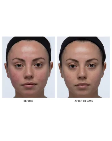 Algenist ELEVATE Advanced Lift Contouring Cream - Vegan Lifting & Firming Moisturizer Treatment with Algae & Peptides - Non-Comedogenic & Hypoallergenic - algenist