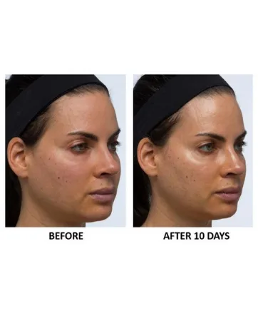 Algenist ELEVATE Advanced Lift Contouring Cream - Vegan Lifting & Firming Moisturizer Treatment with Algae & Peptides - Non-Comedogenic & Hypoallergenic - algenist
