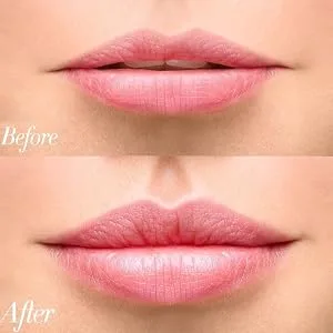 FERNIDA Lip Plumpers Tool Lips Care Enhancer Fuller Thicker Mouth Pumps Fastly Lip Plumping Bigger Device Peach Red - product information 27