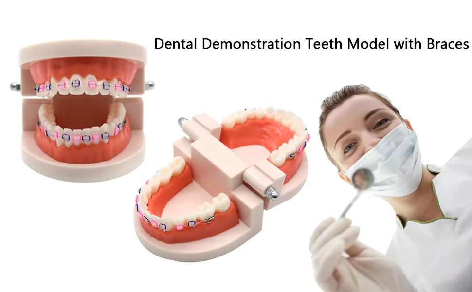 Angzhili 1 Piece Dental Demonstration Orthodontic Model with Metal Wires and Bracket (Metal bracket) - product information 1