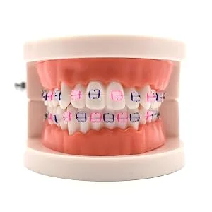 Angzhili 1 Piece Dental Demonstration Orthodontic Model with Metal Wires and Bracket (Metal bracket) - product information 5
