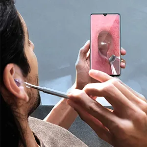 Anykit USB Otoscope for PC & Android Device(NOT for iPhone/iPad)  Ultra Clear View Ear Camera with Ear Wax Removal Tool  Waterproof Ear Scope Endoscope with LED Lights  Ear Cleaning Spoons - ear cleaner