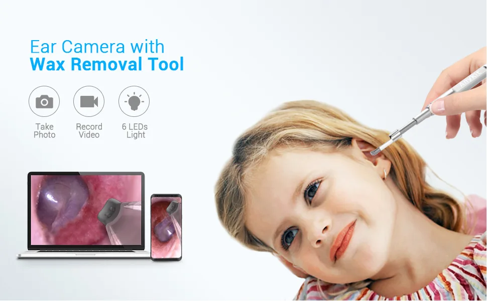 Anykit USB Otoscope for PC & Android Device(NOT for iPhone/iPad)  Ultra Clear View Ear Camera with Ear Wax Removal Tool  Waterproof Ear Scope Endoscope with LED Lights  Ear Cleaning Spoons - usb otoscope camera