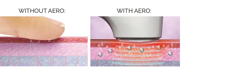 Spa Sciences AERO Skincare Infusion System - for Advanced Anti-Aging Support and Product Absorption - 3-in-1 Infusion - USB Rechargeable - for All Skin Types - aero infusion system