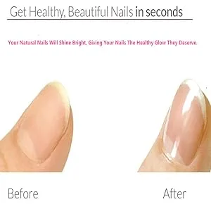 YIMART 5Pcs/set Nail Art Buffer Block Nail File For Nail Polish UV Gel Manicure Pedicure Buffing Sanding Polish (Flower) - product information 11