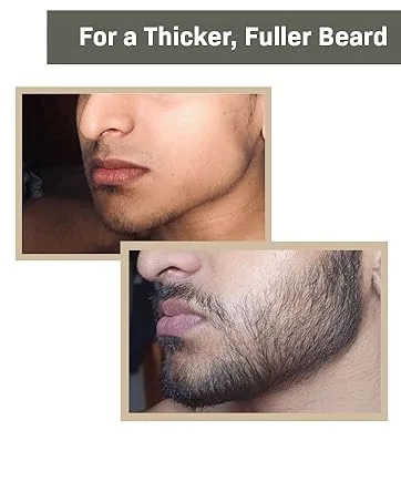 Beard Growth Kit - Hair Growth & Hair Serum - Beard Growth Oil and Beard Roller - Hair Growth for men - Stimulate Beard Growth with our Beard Serum and Growth Roller - Beard Growth Results, growing a beard, beard kit, beard growth kit for black men