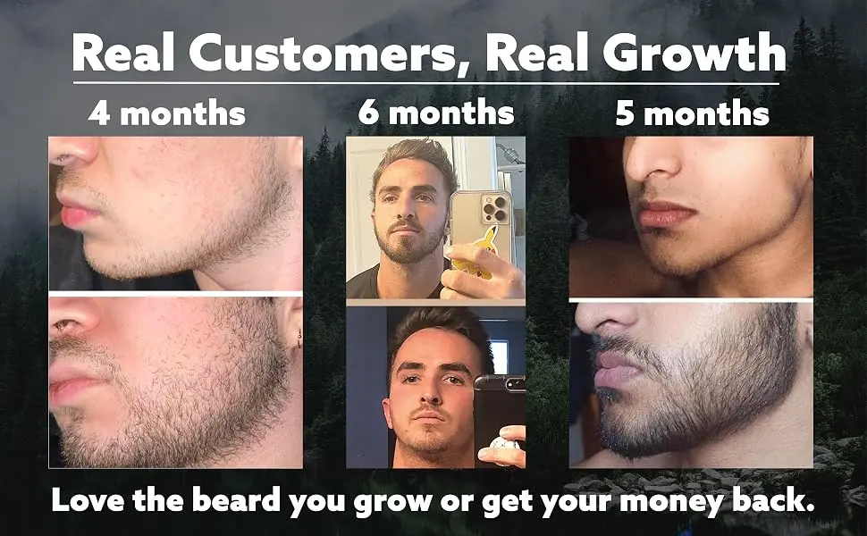 Beard Growth Kit - Hair Growth & Hair Serum - Beard Growth Oil and Beard Roller - Hair Growth for men - Stimulate Beard Growth with our Beard Serum and Growth Roller - Derma Roller Beard, Beard Growth Oil for men, Beard Growing Kit for Men, Beard oil Growth