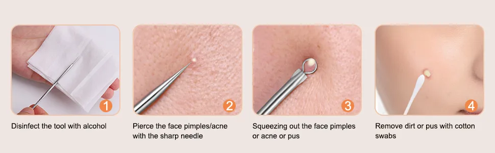 Blackhead Remover  7-in-1 Stainless Steel Pimple Extractor Tool Acne Removal Kit by HAWATOUR - Blackhead Remover