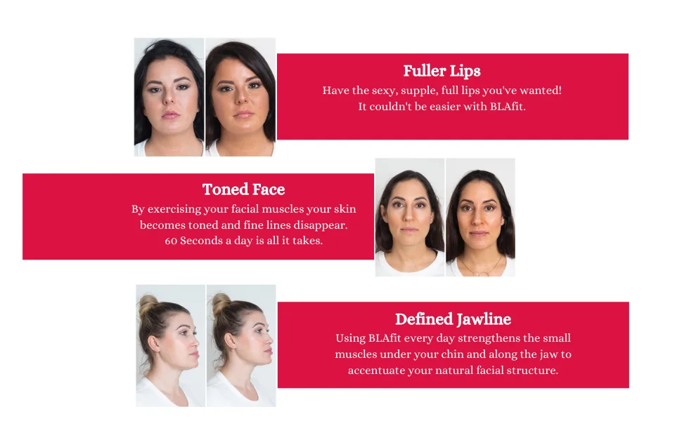 Lip Plumping Device - BLAfit (Bella Lip Appliance) | Anti-Aging Device for Firmer Skin  Plumper Lips  and Defined Jawline (Lavender)) - blafit
