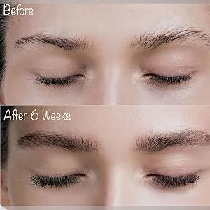 Spectacular BROWS - Brow Enhancer and Brow Growth Serum - Eyebrow Growth Enhancer- Eyebrow Growth Serum with Biotin & Natural Peptides. For Thin  Over-Plucked Eyebrows. Lash & Brow Growth Products - Brow Enhancer, Brow Growth Serum, Eyebrow Growth Enhancer, Lash & Brow Growth Products, lash serum