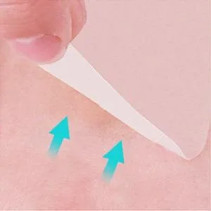 Conkote Hydrocolloid Wound Dressing 4 x 4   Sterile Adhesive Patches  Box of 10 Dressings - bed sore patch