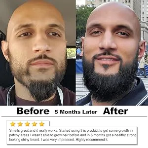 OKAY-MEN Castor Oil Beard and Hair Pomade 4oz - castor Benefits