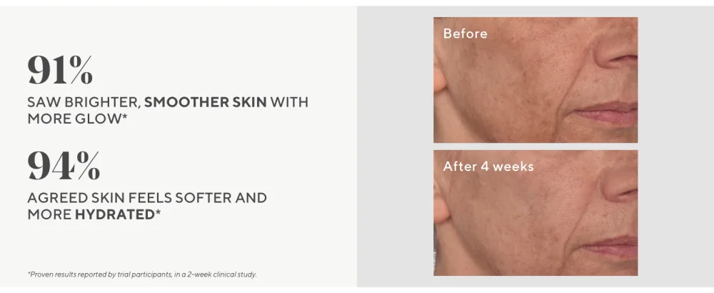 Murad Vita-C Glycolic Serum - Environmental Shield Skin Brightening Vitamin C Face Serum - Hyperpigmentation Treatment Backed by Science  1 Fl Oz - claims
