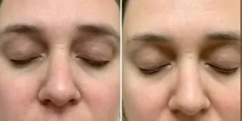 Bella & Bear Hello Glow Face Mask for refining and brightening - Vegan - 6.7oz - Face Mask Before & After