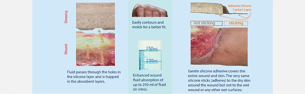 Sacral Dressing 10 Per Box Ultra-Absorbent Silicone Foam with Adhesive Border and Flaps 9.1 x 10.2 Sterile by Areza Medical - Sacral Dressing 10 Per Box Ultra-Absorbent Silicone Foam with Adhesive Border and Flaps