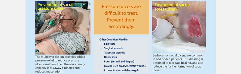 Sacral Dressing 10 Per Box Ultra-Absorbent Silicone Foam with Adhesive Border and Flaps 9.1 x 10.2 Sterile by Areza Medical - Sacral Dressing 10 Per Box Ultra-Absorbent Silicone Foam with Adhesive Border and Flaps
