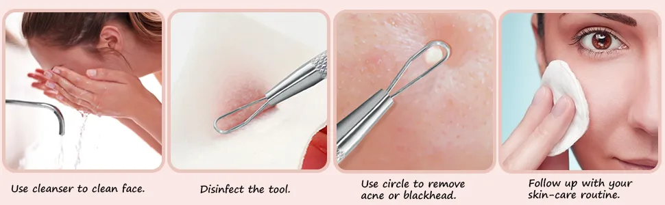 Professional Blackhead Remover Blemish Extractor Tool - Pimple Comedone Removal 2-In-1 Stainless Steel Pimple Popper(2pcs) - acne extractor tool