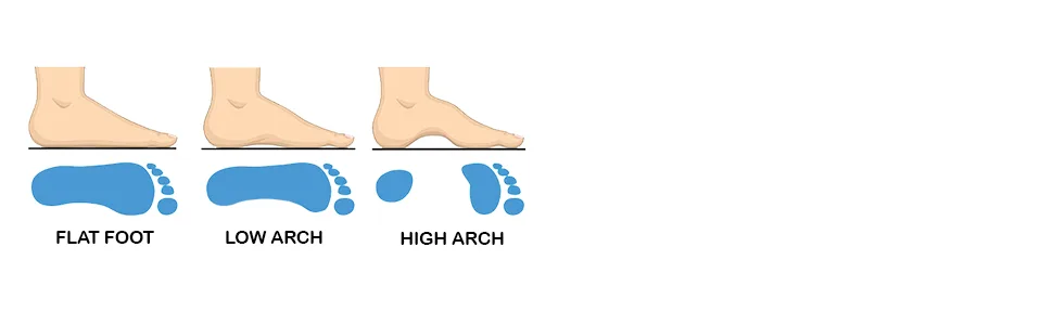 Custom FEET Personalized Orthotics Insoles for Men Women Kids Foot Arch Support (Dynamic Blue Insoles) - flat foot, low arch, high arch