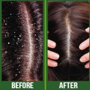 Difeel Premium Castor Plus Vitamin E - Pro-Growth + Anti-Frizz Premium Hair Oil 2.5 oz. - Before/After