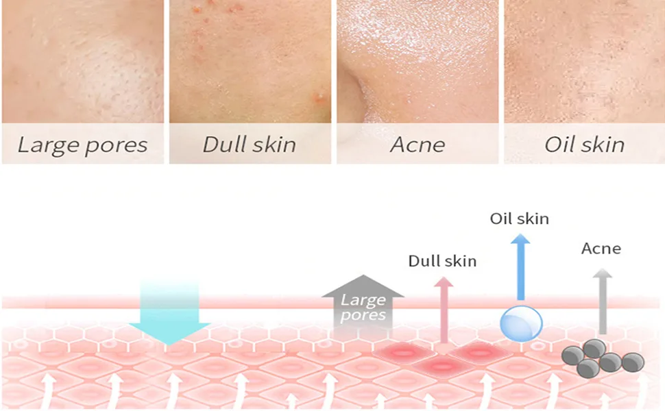 BEUKING Face Camomile Peeling Gel Deep Cleansing Moisturizing Smoothing Gentle Exfoliating Remove Dirt Tighten Pores Improving Face Skin - product information 3