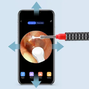 Ear Wax Removal  Earwax Remover Tool with 1080P HD  Waterproof  Easy Use  3.5mm Ear Camera with 6 LED Lights  Earwax Removal Tools for iOS & Android  Kids & Adults - 300*300