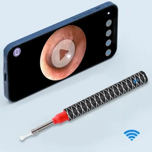Ear Wax Removal  Earwax Remover Tool with 1080P HD  Waterproof  Easy Use  3.5mm Ear Camera with 6 LED Lights  Earwax Removal Tools for iOS & Android  Kids & Adults - 300*300