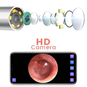 Ear Wax Removal Tools  Otoscope Ear Cleaning Camera Scopearound Ear Endoscope with 6 Adjustable LED Lights  Earwax Removal Camera Compatible with iPhone & Android and Tablet-Pink - Otoscope