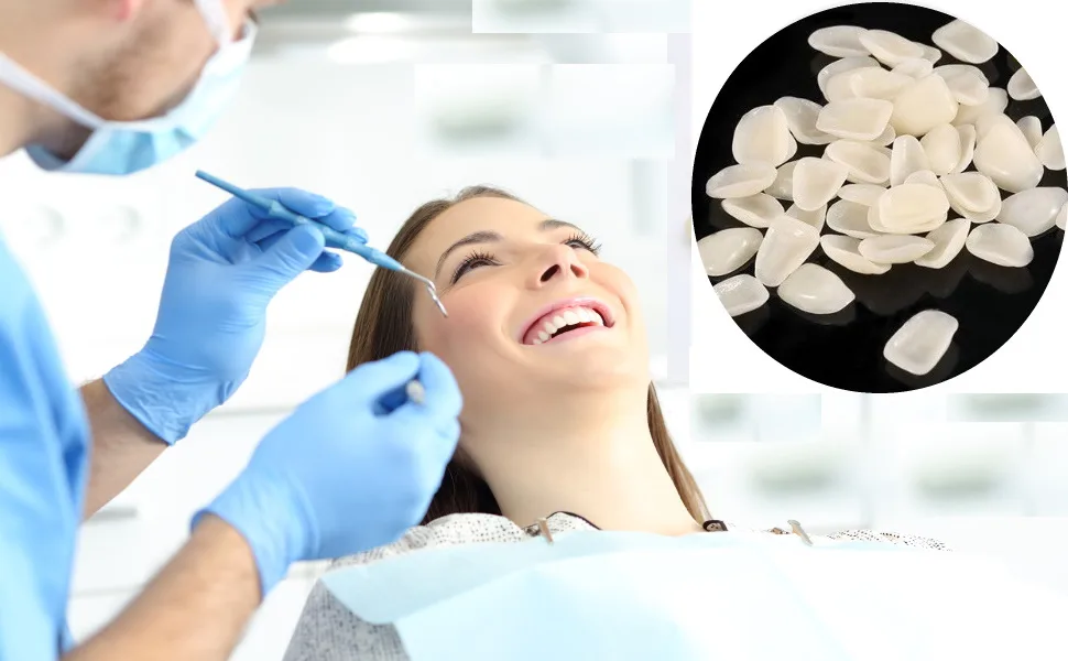 Impressive Smile Ultra Thin Tooth WHITENING VENEERS | COSMETICALY Realistic Looking Solution for Missing OR Broken Teeth | Choose Shade A-1  A-2 or A-3 (A-2) - ULTRA THIN TOOTH WHITENING VENEERS cosmetic improvement realistic appearance