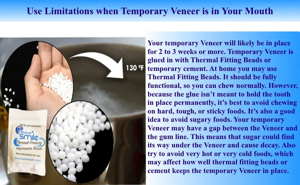 Impressive Smile Ultra Thin Tooth WHITENING VENEERS | COSMETICALY Realistic Looking Solution for Missing OR Broken Teeth | Choose Shade A-1  A-2 or A-3 (A-2) - Use Limitations for Temporary Veneer