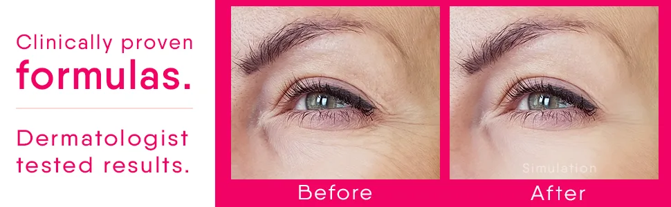 Cicatricure Anti-Wrinkle Day + Night Cream (Bundle) - Cicatricure Antiwrinkle
