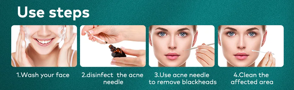 MR.GREEN Professional Blackhead Remover Tool  Pimple Popper Tool kit Blemish Blackhead&Whitehead 2-in-1 Extraction Kit Skin Tools for Face Pimple Popper Needle - MR.GREEN blackhead remover