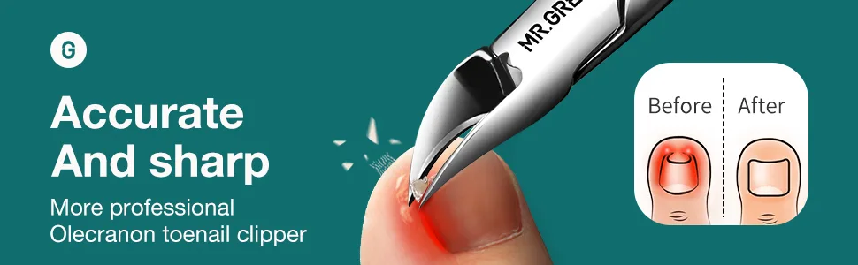 MR.GREEN Nail Clippers Toenail Cutters Anti-Splash Professional Ingrown Thick Hard Nail Scissors Pedicure Tools Manicure Sets (Blue Handle) - 1033-banner