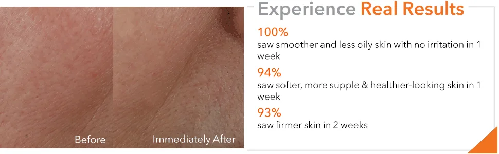 Dr. Dennis Gross Advanced Retinol + Ferulic Texture Renewal Serum: for a Smooth  Retextured Complexion 1 oz Retinol and Ferulic - Advanced Retinol + Ferulic Texture Renewal Serum 1oz