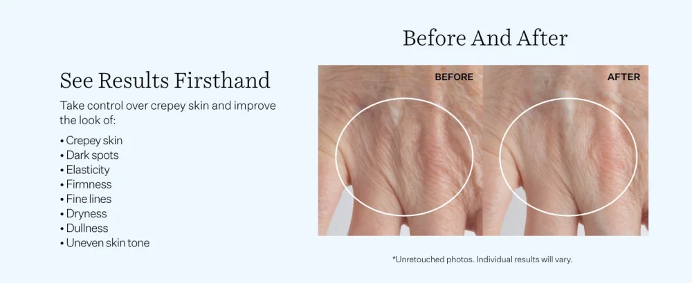 StriVectin Crepe Control Brightening & Firming Hand Cream for Dry Skin and Less Wrinkles  2 oz - Hand