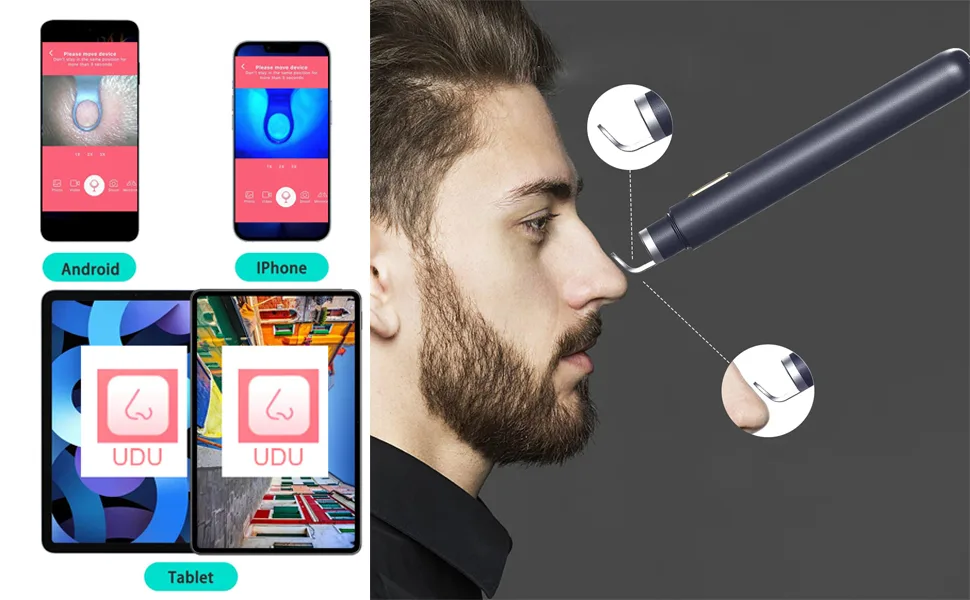 Blackhead Remover with Camera  WiFi Visual Blackhead Remover Tools with White/Blue Lights for iPhone  Android Phones Women Gift (Blackhead Remover - Navy Blue) - Blackhead Remover with Camera