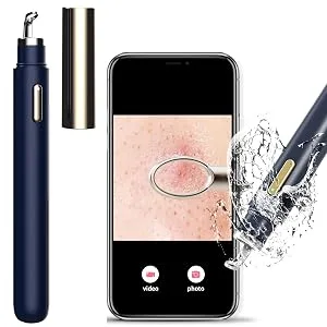 Blackhead Remover with Camera  WiFi Visual Blackhead Remover Tools with White/Blue Lights for iPhone  Android Phones Women Gift (Blackhead Remover - Navy Blue) - Blackhead Remover with Camera