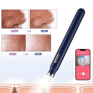 Blackhead Remover with Camera  WiFi Visual Blackhead Remover Tools with White/Blue Lights for iPhone  Android Phones Women Gift (Blackhead Remover - Navy Blue) - Blackhead Remover with Camera
