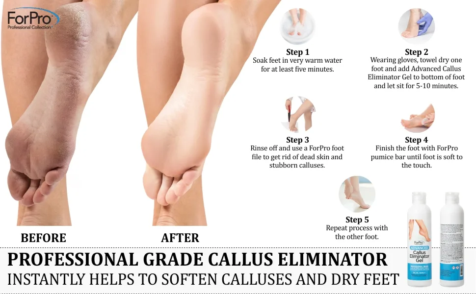 ForPro Advanced Callus Eliminator Gel  Professional Grade  No Drip Callus Remover Gel for Feet  8 oz. - ForPro Advanced Callus Eliminator Gel