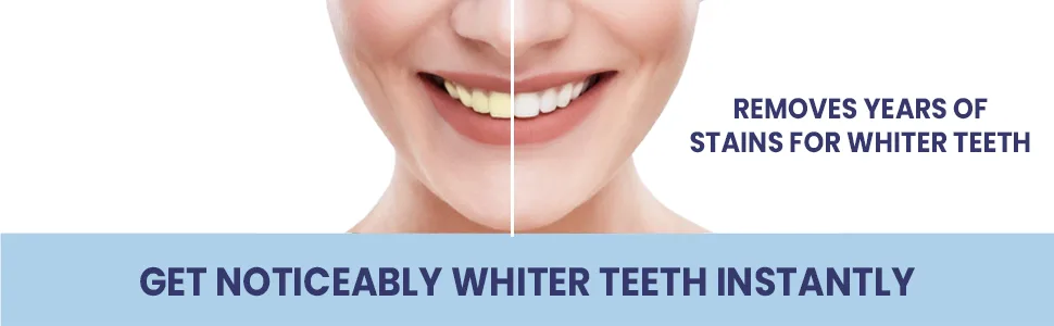 CustMbite Premium Gentle Teeth Whitening Foam For Sensitive Teeth - Get Noticeably Whiter Teeth Instantly