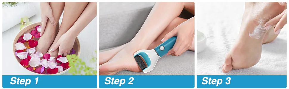 Electric Foot File Callus Remover Professional  2-Speed Rechargeable Pedicure Tool for Remove Calluses  Dry  Hard  Dead  Cracked Skin  Includes 2 Coarses (Blue) - product information 5
