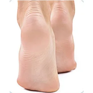 DEFUTAY Foot File Callus Remove Metal Tool Heel Foot Scraper for Dead Skin Callus Hard Skin Remover  Cracked Heelr (Black) - Foot File