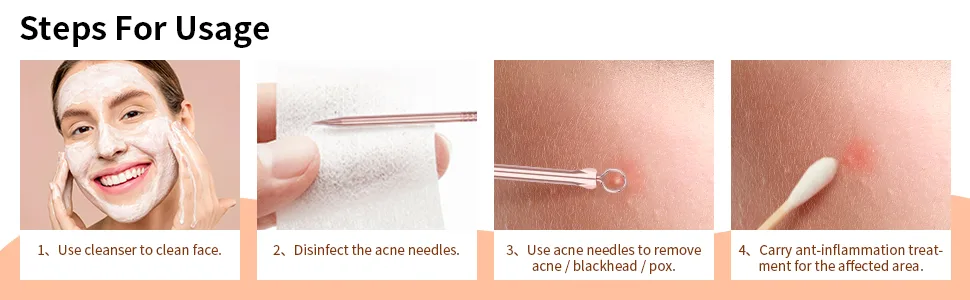 DUcare Blackhead Remover Comedone Extractor Acne Removal Kit for Blemish  4Pcs Professional Pimple Popper Tool Kit  Stainless Steel (Gold) - Blackhead Remover