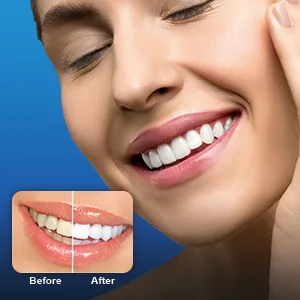 Teeth Whitening Kit White Tooth - DOUCEUR Teeth Whitener Professional with 32X LED Bleaching Light 3Pcs Non Sensitive Teeth Whitening Gel Pens - for Smile White Teeth Quickly and Gently Black - product information 4
