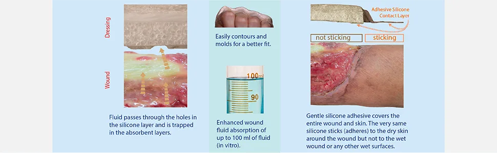 Areza Sacral Dressing 10 Per Box Ultra-Absorbent Silicone Foam with Adhesive Border and Flaps 7.2 x 7.8 Sterile 7.2 x 7.8 Inch - Areza Sacral Dressing 10 Per Box Ultra-Absorbent Silicone Foam
