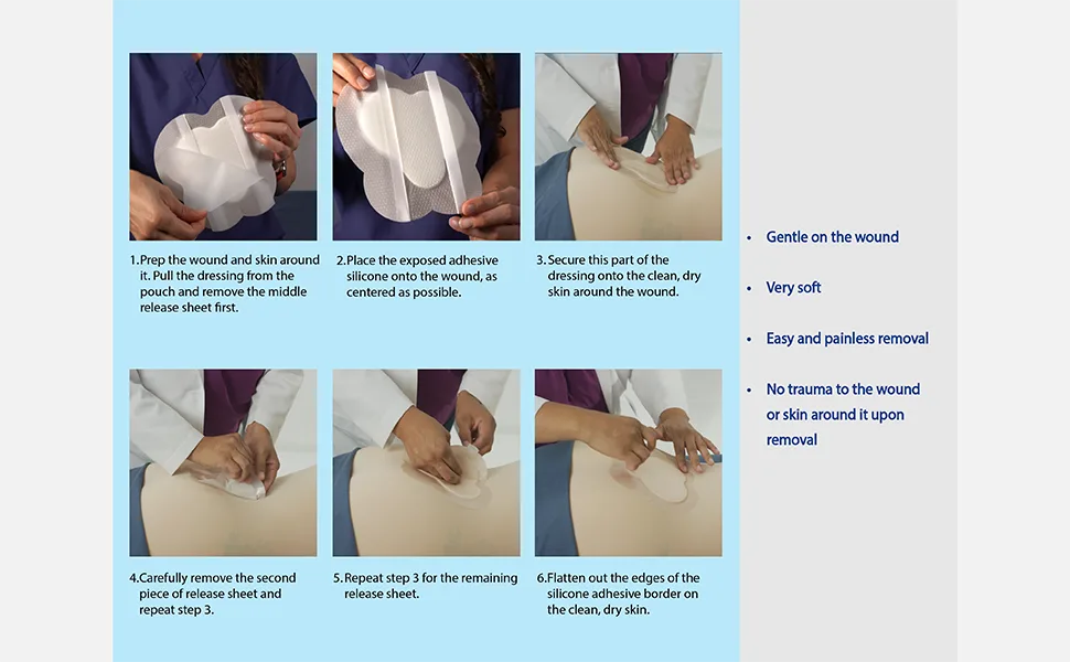 Areza Sacral Dressing 10 Per Box Ultra-Absorbent Silicone Foam with Adhesive Border and Flaps 7.2 x 7.8 Sterile 7.2 x 7.8 Inch - Areza Sacral Dressing 10 Per Box Ultra-Absorbent Silicone Foam