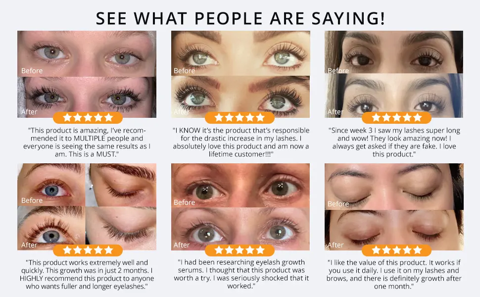 EssyNaturals Eyebrow Growth Serum  Irritation Free Formula  Guaranteed Results in 3-4 Weeks for Longer  Thicker  and Fuller Eyebrow - product information 6