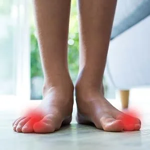 Toe Orthopedic Bunion Corrector Spacer & Gel Spreader (Three Toe Spacers (3 Pairs)) - product information 2