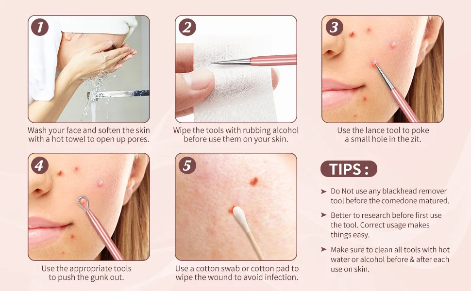 Blackhead Remover Tool TsMADDTs 6 Pcs Pimple Popper Tool Acne Extractor Removal Tool for Nose Face with Portable Leather Bag(Rose Golden) - product information 13